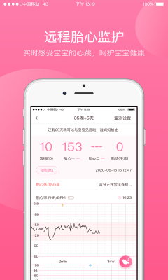 掌上孕育